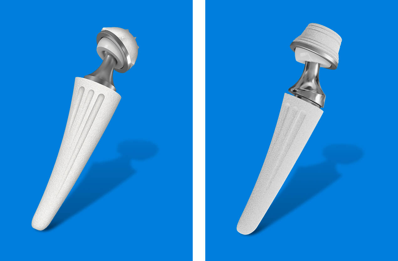 cmcj-replacement Thumb CMC joint replacement surgery for arthritis relief