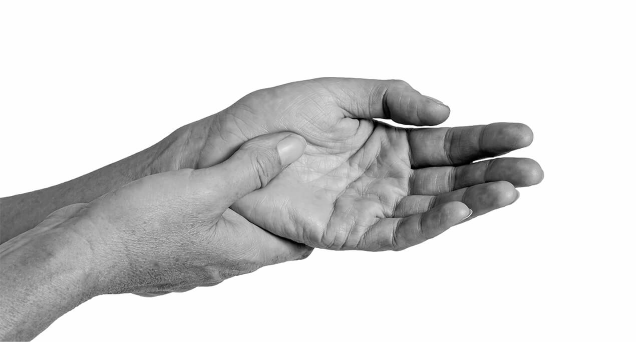 Median and ulnar nerve compression conditions including carpal tunnel syndrome
